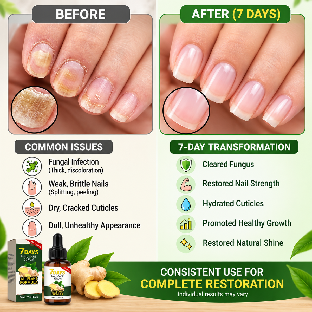 Nail Care Serum 100ml Each Pack Of 2