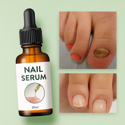 Nail Repair Serum Pack Of 2