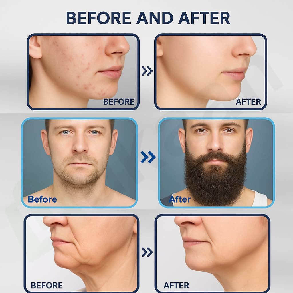 Derma stamp for Hair & Beard regrowth Brand Product