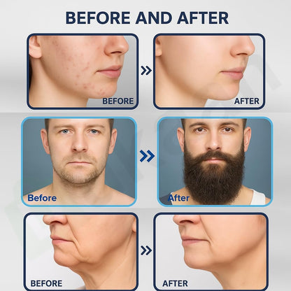 Derma stamp for Hair & Beard regrowth Brand Product